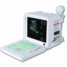 DW-360 high quality image portable ultrasound machine price